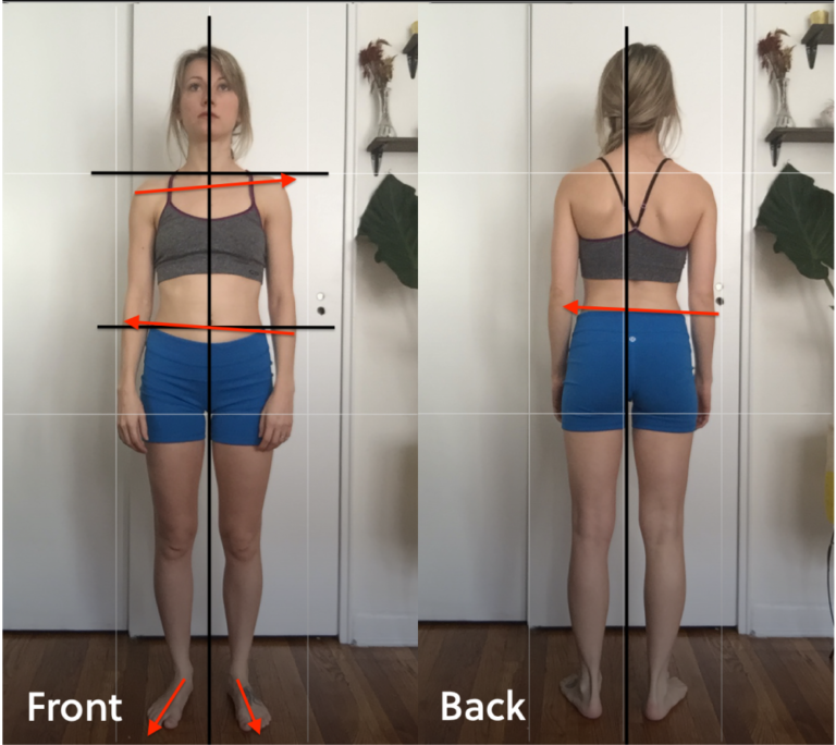 move with hpa postural alignment demonstration of misalignments on female front and back view