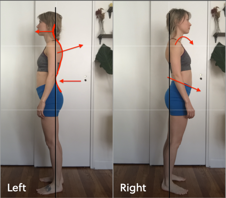 move with hpa postural alignment demonstration of misalignments on female in side view